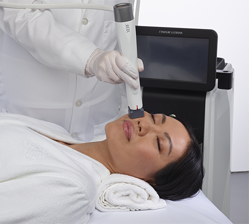 Client having XERF skin tightening treatment at Skin Story Clinic, London